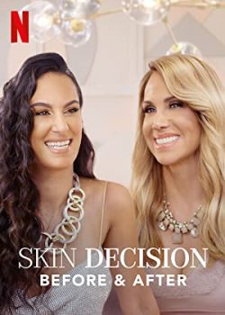 Lựa Chọn Lột Xác: Trước Và Sau (Phần 1) - Skin Decision: Before and After (Season 1)